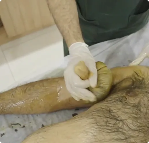 Patra-Pottali Swedan