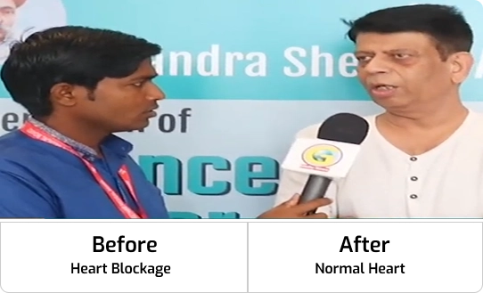 h_before_after 1
