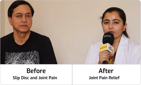 joint_pain_bfr_aftr 2