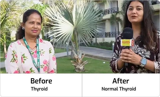 thyroid thyroid-1