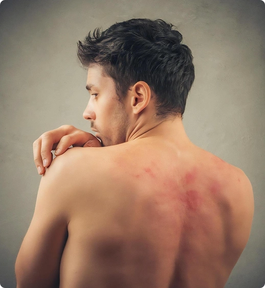 what-is-skin-disease