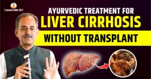 Liver-Cirrhosis-Treatment