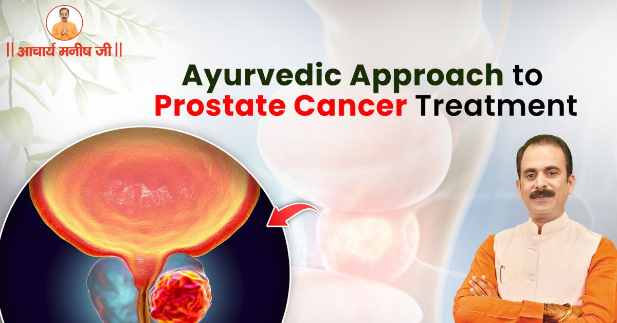 Ayurvedic Approach to Prostate Cancer Treatment in Ayurveda by Acharya Manish Ji