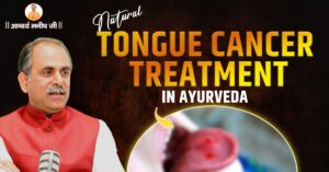 Tongue-Cancer-Treatment