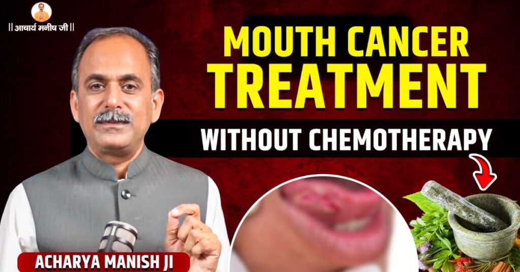mouth-cancer-treatment