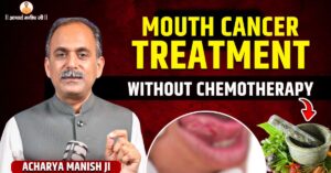mouth-cancer-treatment