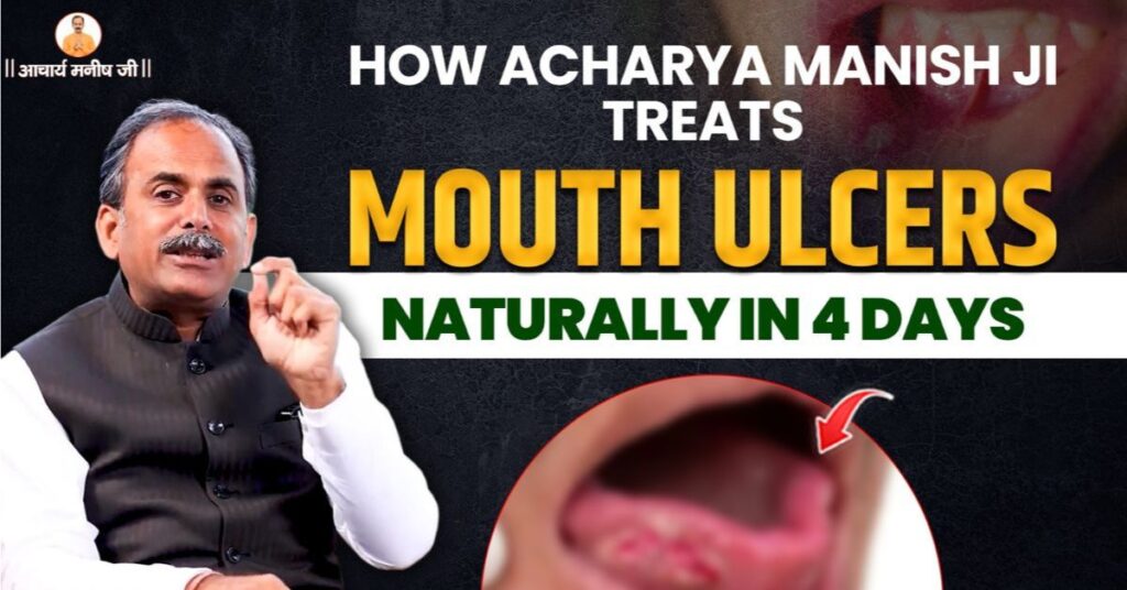 mouth-ulcer-treatment