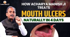 mouth-ulcer-treatment