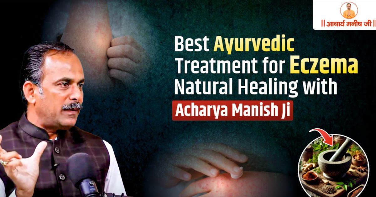 Best Ayurvedic Treatment for Eczema – Natural Healing with Acharya Manish Ji