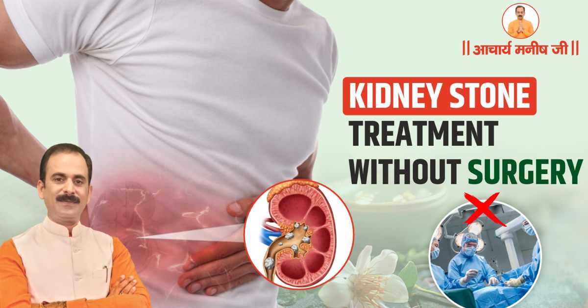 Kidney Stone Treatment Without Surgery – Acharya Manish Ji’s Holistic Healing Guide