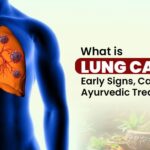What is Lung Cancer? Early Signs, Causes & Best Ayurvedic Treatment
