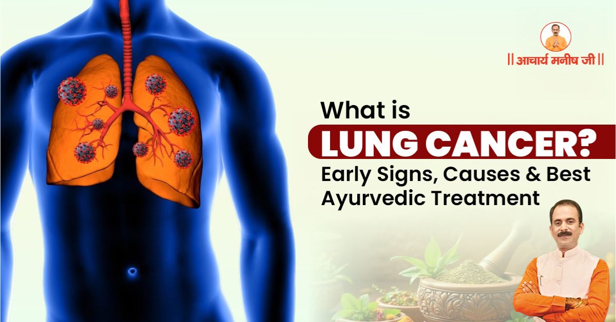 What is Lung Cancer? Early Signs, Causes & Best Ayurvedic Treatment