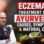 Eczema Treatment in Ayurveda: Causes, Symptoms & Natural Care