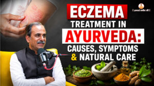 Eczema-Treatment-in-Ayurveda