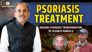 Psoriasis-Treatment