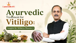 Ayurvedic-Treatment-for-Vitiligo