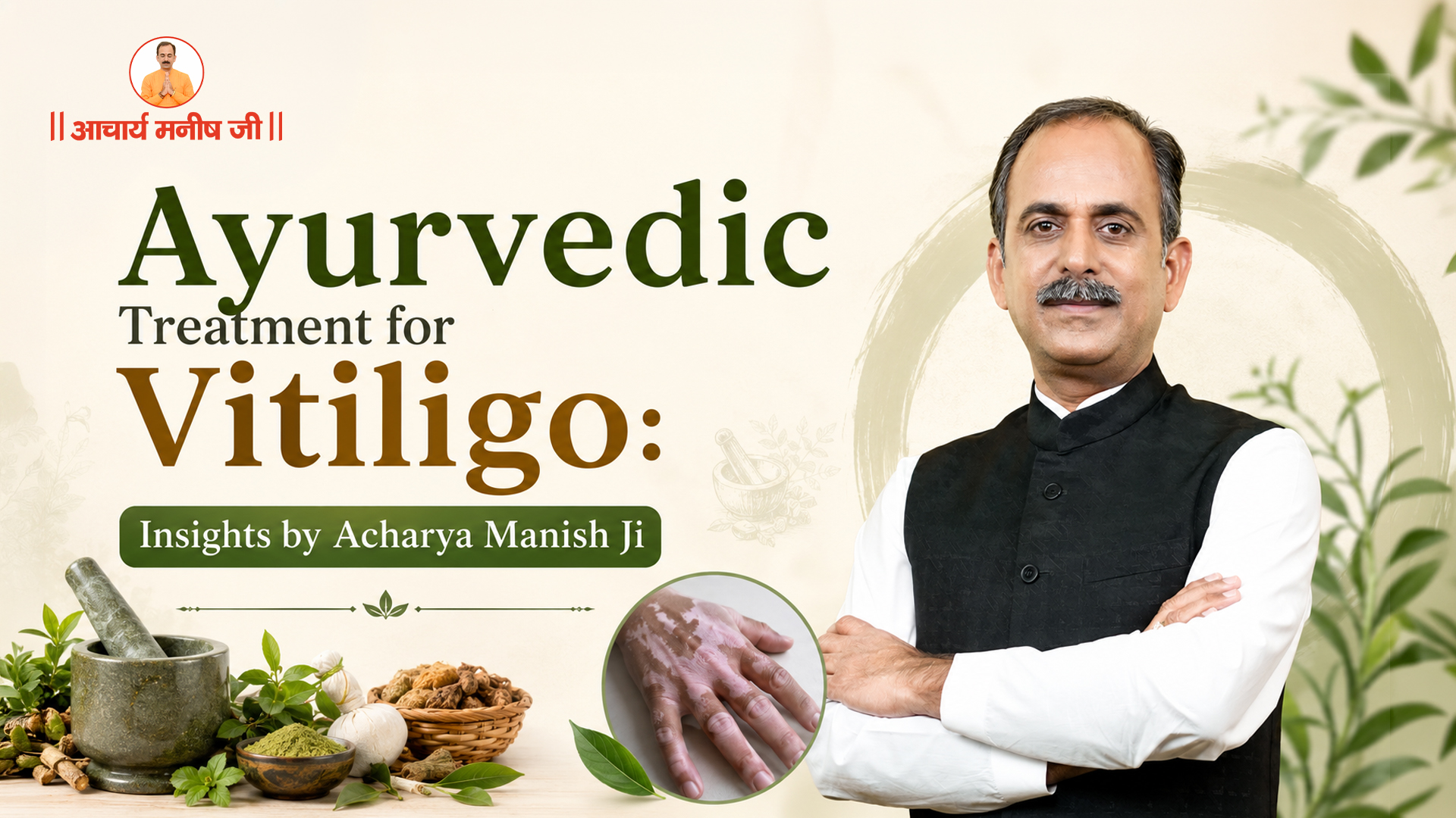 Ayurvedic Treatment for Vitiligo: Insights by Acharya Manish Ji