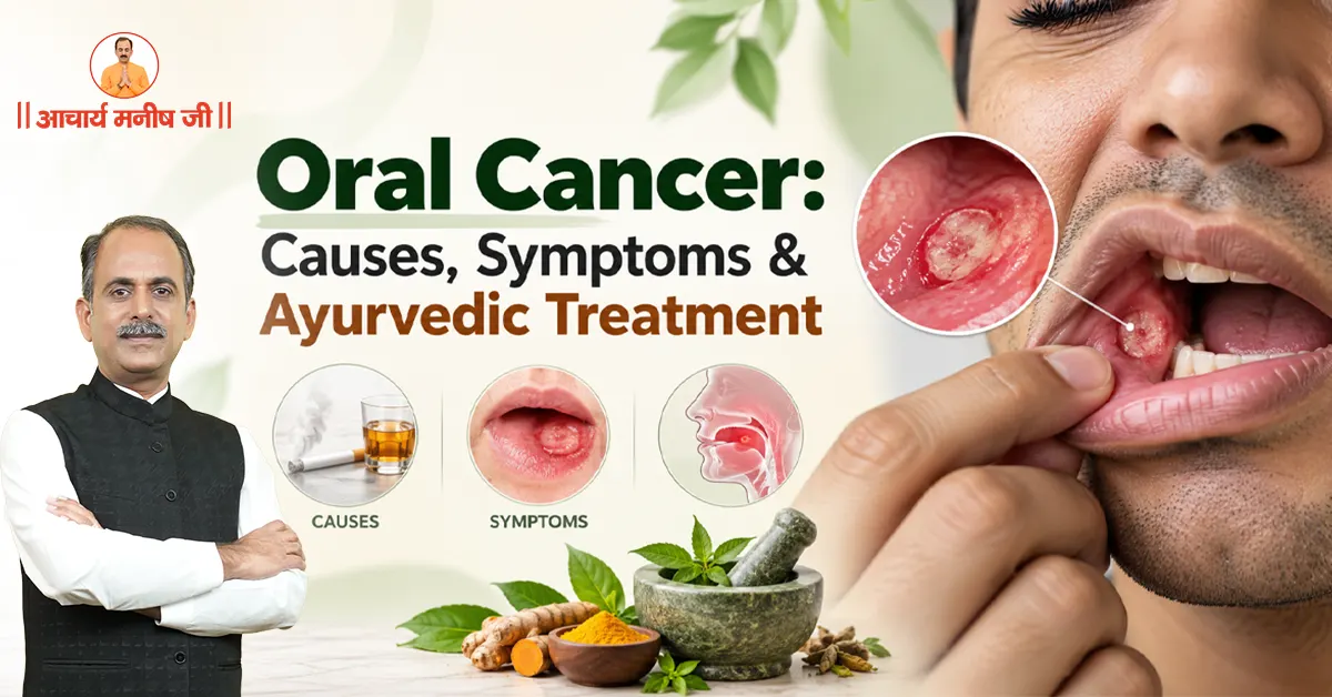 Oral Cancer: Causes, Symptoms & Ayurvedic Treatment